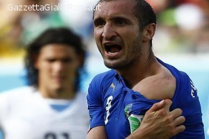 Chiellini mostra i segni del morso di Suarez